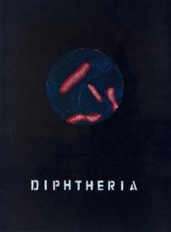 Diphtheria