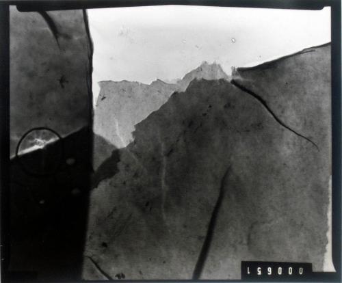 untitled (electron micrography)