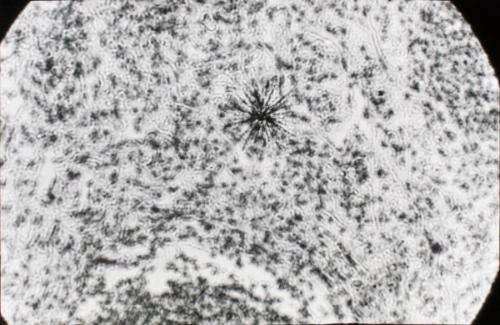 Particle of Plutonium in Lung Tissue of an Ape