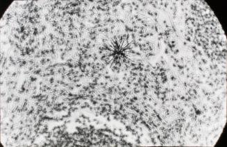 Particle of Plutonium in Lung Tissue of an Ape